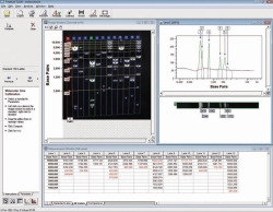 Imagen Gel documentation system microDOC with UV-Transilluminator